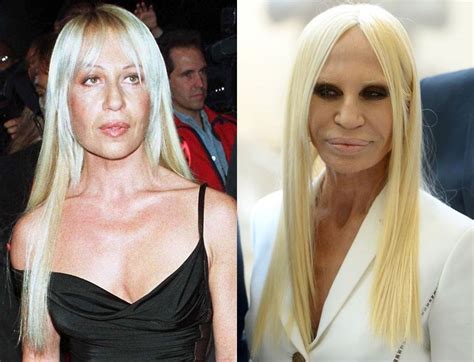 canzone dedicata a donatella versace|donatella versace before and after surgery.